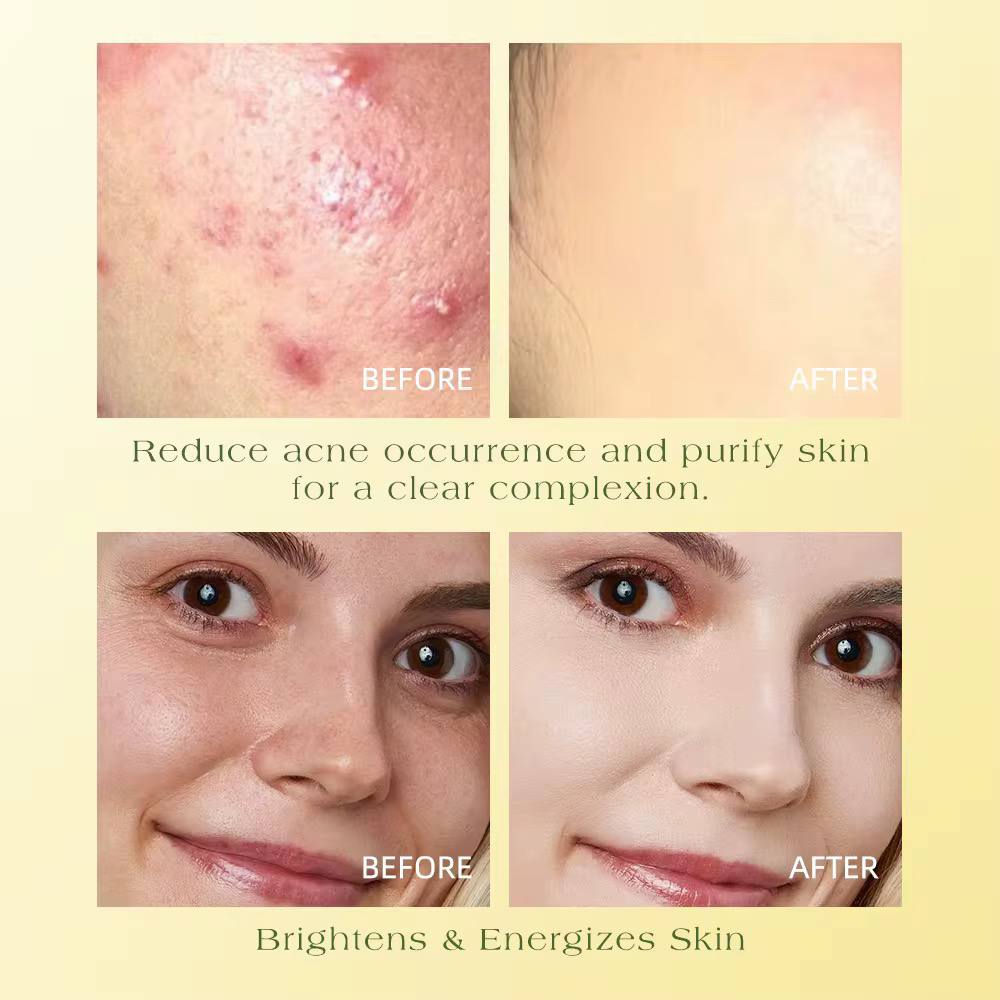 TWS Lot de 50 tampons nettoyants naturels et biologiques à l'acide kojique, au curcuma, tampons nettoyants pour le visage – Image 4