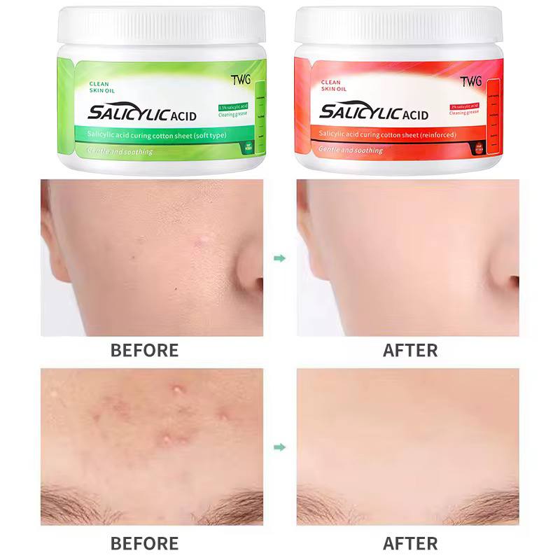 TWG Lot de 50 Tampons nettoyants pour le visage à l'acide Salicylique – Image 4