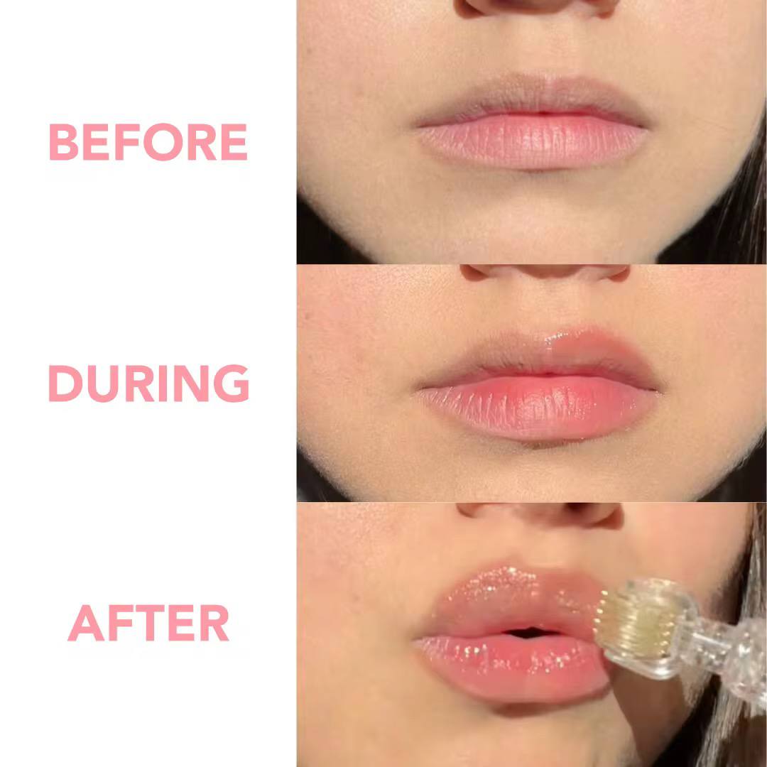 Biolips™ – Roller & Sérum Hyaluronique – Image 4